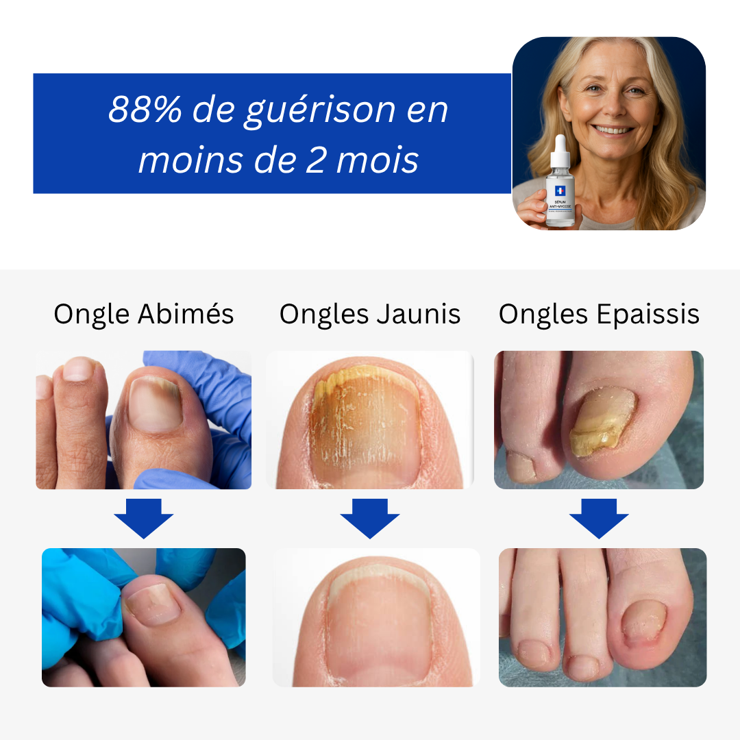 Patchs Anti-Mycoses