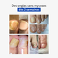 Cure Anti-Mycoses